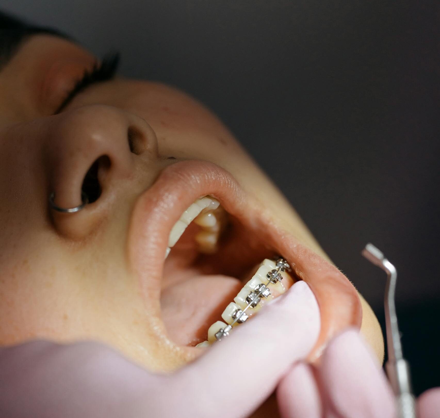 Dentist examining patient's braces during a dental appointment.